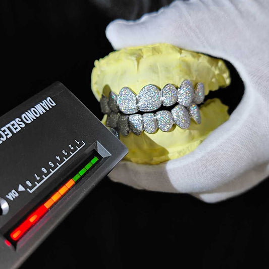 Moissanite Diamond Grillz – Custom Luxury Fit