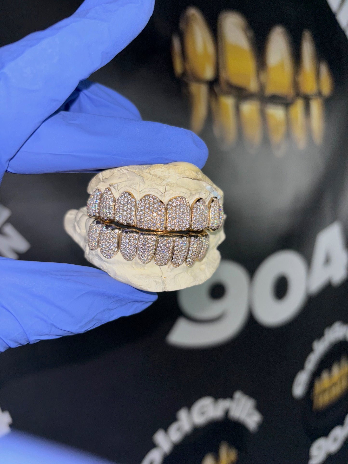 Moissanite Diamond Grillz – Custom Luxury Fit