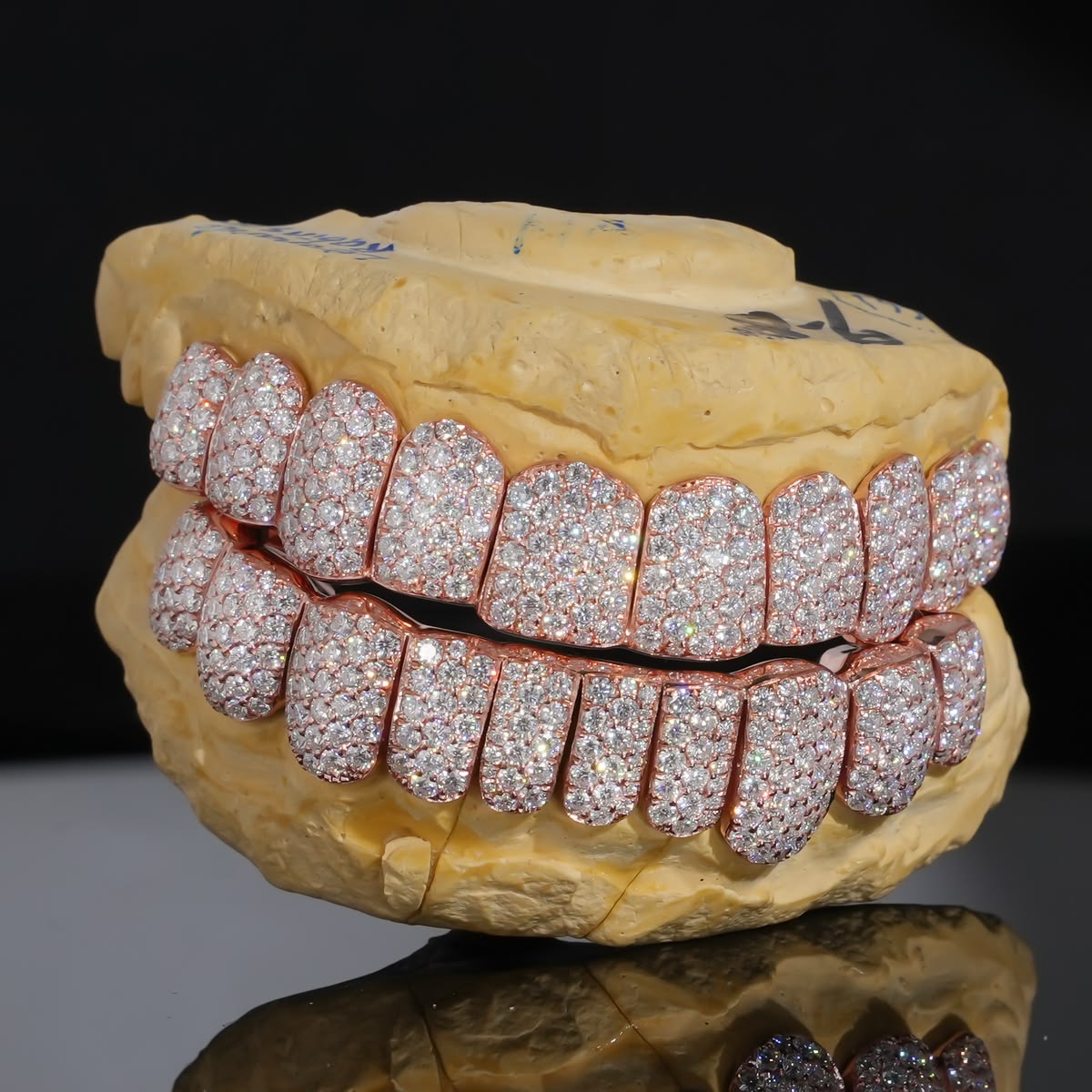 Moissanite Diamond Grillz – Custom Luxury Fit