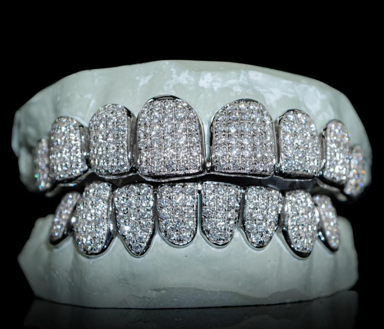 VVS Lab Diamond Grillz – Custom Luxury Fit