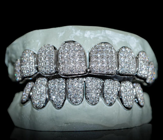 VVS Lab Diamond Grillz – Custom Luxury Fit